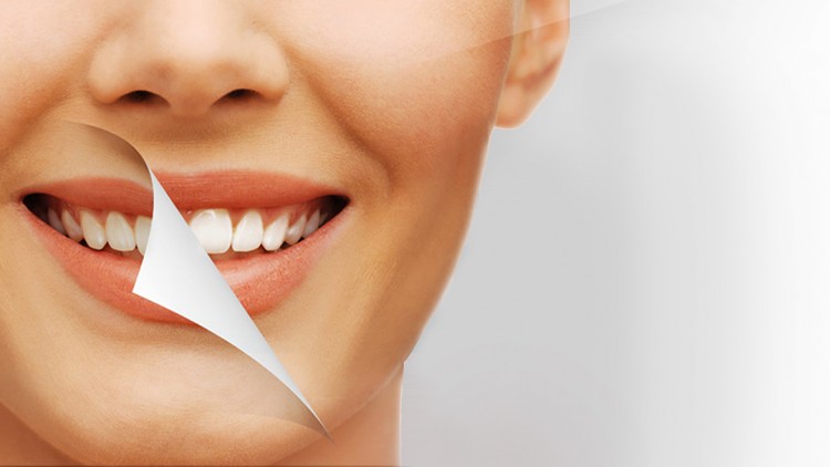 Blanqueamiento y limpieza dental